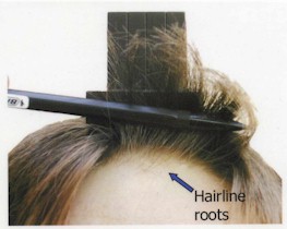 HairRoots.jpg